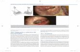 Introducción al maneo uirrgico de la enfermedad crónica ...media.axon.es/pdf/115859_4.pdf · También se inyecta anestesia local superiormente al sitio del músculo temporal, inferior