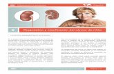 32 Diagnóstico y clasificación del cáncer de riñónpatients.uroweb.org/wp-content/uploads/Cancer-de-rinon-Diagnosis... · extendido a los pulmones le realizará más estudios