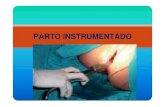PARTO INSTRUMENTADO - NOTICIAS | UVS Fajardouvsfajardo.sld.cu/sites/uvsfajardo.sld.cu/files/parto_instrument... · • Distocias de progresión: Maternas • Enfermedades médicas:
