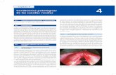 Capítulo 4 Condiciones patológicas 4 de las cuerdas …media.axon.es/pdf/93821_1.pdf · lesiones de la cuerda vocal, en especial las relacionadas con el trata - miento quirúrgico.