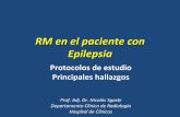 RM en el paciente con Epilepsia - Sociedad de … · • Pérdida de la anatomía normal de la cabeza hipocampal • Atrofia del cuerpo mamilar y fórnix ipsi-lateral • Dilatación