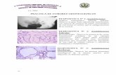 PRACTICA DE TUMORES ODONTOGENICOS …ucv.ve/.../Anatomia_Patologica/Practica_Tumores_Odontogenicos.pdf · PRACTICA DE TUMORES ODONTOGENICOS DIAPOSITIVA Nº 1: Ameloblastoma: Aspecto