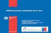 Malformaciones congénitas de la cara - deis.cl · Gobierno de Chile / Ministerio de Salud MFC DE LOS PARPADOS BLEFAROFIMOSIS 1,9 cm PTOSIS PALPEBRAL
