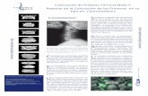 Colocación de Prótesis Cervical Mobi-C Reporte de la ... Edicion Nov11.pdf · colocación de un disco artificial que en este caso corresponde a los deno- ... del disco que se practica