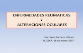 ENFERMEDADES REUMATICAS Y ALTERACIONES … reumáticas.pdf · Y ALTERACIONES OCULARES Dra. Rosa Burdeus Gómez HUESCA. 16 de marzo 2017. ENFERMEDADES REUMATICAS Y ALTERACIONES OCULARES