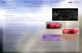 GIST DE MESOCOLON TRANSVERSO - ACN … · de colon transverso. • Resección de dicho segmento y anastomosis T-T manual Alberdi San Román I., Martínez Roldán A., Jiménez Jiménez