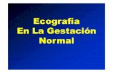 Ecografia En La Gestación Normal - UNNE - Inicio · –– Posición: Es la relación que tiene el dorso fetal con la madre. AA.2) Biometria Fetal.2) Biometria Fetal: Diametro Biparietal