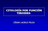 CITOLOGÍA POR PUNCIÓN TIROIDEA - XXV …seapcongresos.com/2011/SEC/19_mayo_jueves/0.3/08.00/Cesar_Lacru… · PAAF TIROIDES Maligno Neoplasia Folicular (20% Malignas) Benigno No