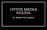 OTITIS MEDIA AGUDA. - otorrinomexico.com · hiperemia del mucoperiostio salida de suero, fibrina, eritrocitos y PMN desde los capilares permeables dilatados.