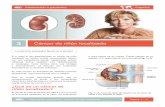 figuran en el glosario. - patients.uroweb.org · Información a pacientes - Cáncer de riñón localizado Página 4 / 14 riñón tumor uréter vena cava porta Nefrectomía parcial