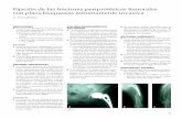 Fijación de las fracturas periprotésicas femorales con ...orthotrauma.es/assets/pdf/volume2/04-fijacion-de-las-fracturas.pdf · estado vasculonervioso y de la longitud de las extremidades