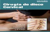 Cirugía de disco cervical (PDF) - veteranshealthlibrary.org · Es posible que el médico le indique descanso, medicamentos, fisioterapia, ejercicios o inyecciones. Estos tratamientos