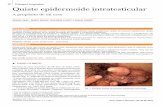 56 Trabajos originales Quiste epidermoide intratesticular Quiste epidermoide... · La lesión cuando está presente representa la unidad pilosebácea cerrada, de la cual se pueden