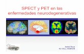 SPECT y PET en las enfermedades neurodegenerativas · nÚmero de personas con demencia en los paises desarrollados y en ... spect tipo imagen pet 99mtc-hmpao perfusiÓn 15o-h2o 99mtc-ecd