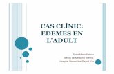 CAS CLÍNIC: EDEMES EN L’ADULT - Annals del Sagrat Cor · •Insuficiència renal aguda secundària a síndrome nefròtic ... - GMN membranosa !30% - Glomeruloesclerosi focal i