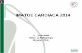 IMATGE CARDIACA 2014 - Home | Acadèmia de Ciències ... · Prospectiu, 205 pac. de risc intermig-alt amb angina estable PE convencional, SPECT estrés-repós, score Ca++ i TAC coronari