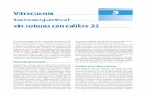 Vitrectomía 5 transconjuntival sin suturas con calibre 25media.axon.es/pdf/78870_1.pdf · sin suturas con calibre 25 La vitrectomía transconjuntival sin suturas con calibre 25 fue