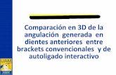 Presentación de PowerPoint - Universidad Autónoma de ...repositorio.autonoma.edu.co/jspui/bitstream/11182/625/1... · brackets de autoligado interactivo en los incisivos centrales,