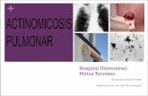 Hospital Universitari Mútua Terrassa - academia.cat pulmonar.pdf · CASO CLÍNICO MC: Varón de 60a derivado del CAP por infiltrado en Rx. ... 1-2 meses después de resolución radiológica.