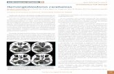 DIAGNÓSTICO POR IMAGEN Hemangioblastoma cerebelosomgyf.org/wp-content/uploads/2017/revistas_antes/V2N5/V2N5_165_168.pdf · tomografía computarizada (TC) craneal. En la TC en el