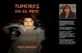 Tumores en el arte - olgamarquess.comolgamarquess.com/descarga-muestra-del-libro/tumores-en-el-arte_Olga... · Un tumor es toda masa neoplásica o masa de tejido anormal que tiende
