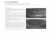 PLASMOCITOMA TESTICULAR BILATERAL CONCLUSIÓN …hpc.org.ar/images/revista/878-60-Plasmocitoma testicular.pdf · Plasmocitoma extramedular (pared anterior del tórax y piel de muslo).