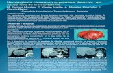 Hemangioma cavernoso suprarrenal derecho: una causa rara ... · RMN: Masa suprarrenal derecha de 7 x 6 cms de diámetro con zona quística en su interior, hiperintensa en T2. !Con