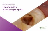 Máster Online en Endodoncia y Microcirugía Apical · 6.1. Una o varias sesiones en endodoncia 6.1.1. Pautas a seguir para finalizar una endodoncia 6.2. Secado y preparación dentinaria