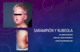 SARAMPIÓN Y RUBEOLA · 2016-06-15 · SARAMPIÓN • enfermedad exantemática vírica de distribución universal • alta tasa de morbilidad y mortalidad • enfermedad controlada