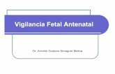 Vigilancia Fetal Antenatalrespyn2.uanl.mx/especiales/2006/ee-01-2006/documentos/13.pdf · Vigilancia Fetal Antenatal Riesgo Obstétrico La probabilidad de que se produzca una situación