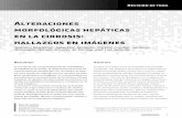 Alteraciones morfológicas hepáticas en la cirrosis: hallazgos en … · 2016-11-16 · hepáticas en la cirrosis ... La presencia de lesiones focales hepáticas sobre un hígado