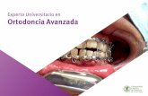 Experto Universitario en Ortodoncia Avanzada · Este Experto Universitario en Ortodoncia Avanzada contiene el programa científico más completo y actualizado del mercado. Tras la