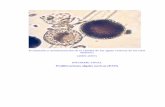 Proliferaciones algales nocivas (PAN)costabalearsostenible.es/PDFs/Calidad_Aguas_Vertidos... · 2012-11-22 · Evaluación y monitorización de la calidad de las aguas costeras de