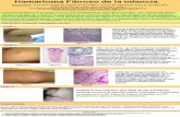 Adobe Photoshop PDF - SDPLdemuestre el componenete trifásico característico de este tumor (tejido adiposo maduro, proliferación fusocelular en haces de tejido fibroso denso y tejido