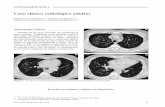 Caso clínico radiológico adultos - SciELO · 2010-04-22 · Nuestro paciente cumple con las característi-cas de este cuadro de calcificación metastásica del pulmón tanto clínico
