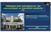 Hallazgos post quirúrgicos en las neurocirugías: su valoración · PDF file 2019-02-19 · COMPLICACIONES SINDROME DEL TREPANO HERNIA PARADOJAL Resulta de la exposición de los contenidos