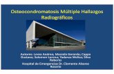 Osteocondromatosis Múltiple Hallazgos Radiográficoscongreso.faardit.org.ar/uploads/2014/poster/2014_519_PE... · 2019-02-19 · lugar con la Displasia Epifisaria Hemimélica o Enfermedad