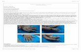 Revista de nefrología, díalisis y trasplante · 2016-11-22 · Renal 21/11/16 17’24  Página 1 de 2 Revista de nefrología, díalisis y trasplante Versión On ...