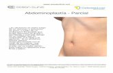 Abdominoplastía - Parcial · Procedimiento Su cirujano hará una incisión justo por encima del área púbica. La incisión normalmente se realiza de forma que quede oculta debajo
