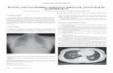 Patrón micronodulillar pulmonar bilateral. ¿Variedad de …scielo.isciii.es/pdf/sm/v75n3/1887-8571-sm-75-03-170.pdf · 2020-01-16 · El patrón micronodulillar bilateral implica