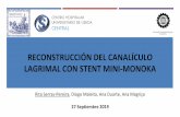 RECONSTRUCCIÓN DEL CANALÍCULO LAGRIMAL CON …11 pacientes sometidos a cirugía de reconstrucción de canalículo lagrimal con uso de stent Mini Monoka, 8 debido a la laceración