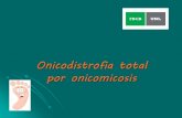 Onicodistrofia total por onicomicosis · Recomendaciones al paciente Evitar el contacto con químicos abrasivos e irritantes. Utilizar guantes de látex (especialmente en su trabajo).