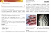 ARTROPATÍA’GOTOSA’medicalum.com/wp-content/uploads/2018/10/MBCC_gota.pdf · La gota es una enfermedad inflamatoria crónica que resulta por el depósito de cristales de Referencias(