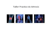 Taller Practico de Artrosis - gva.esalcoy.san.gva.es/cas/hospital/sesclin/2017.10.05 Artrosis... · 2017-10-24 · tratamiento de la artrosis y también es importante insistir en
