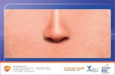 GSKPro for Healthcare Professionals · 2018-12-02 · BroŽek JL. Bousquet J, Baena-Cagnani CE, et al. Allergic Rhinitis and its Impact on Asthma (ARIA): 2010 revision. J AllergyClin