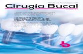 Revista Andaluza de Cirugía Bucal...Las contraindicaciones de esta técnica incluyen las siguientes: - Presencia de infección activa. - Hueso insuficiente. - Ausencia de hueso en