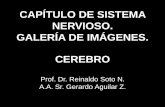 CAPÍTULO DE SISTEMA NERVIOSO. GALERÍA DE IMÁGENES. … · 2016-04-27 · CAPÍTULO DE SISTEMA NERVIOSO. GALERÍA DE IMÁGENES. CEREBRO Prof. Dr. Reinaldo Soto N. A.A. Sr. Gerardo