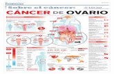 Cáncer de ovario · de ovario Estómago 75% 56% 44% 25% 35% 65% 70% 30% A A C B Tipos d élla dl ovaio Tipos de cáncer de ovario D ogn epitlal D célula gmnal Epitelial: cubn l