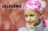 LA LEUCEMIAanatomia1bach.weebly.com/uploads/8/8/5/7/8857465/la... · 2018-09-06 · -Leucemia linfoide crónica (LLC) incluida dentro de los síndromes linfoproliferativos y equiparable