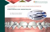 DISEÑO DE ALINEADORES - Ortocervera.comortocervera.com/wp-content/uploads/2020/03/PROGRAMA-A... · Ataches Puntos de presión Sofware de planificación Plan de tratamiento Sofware